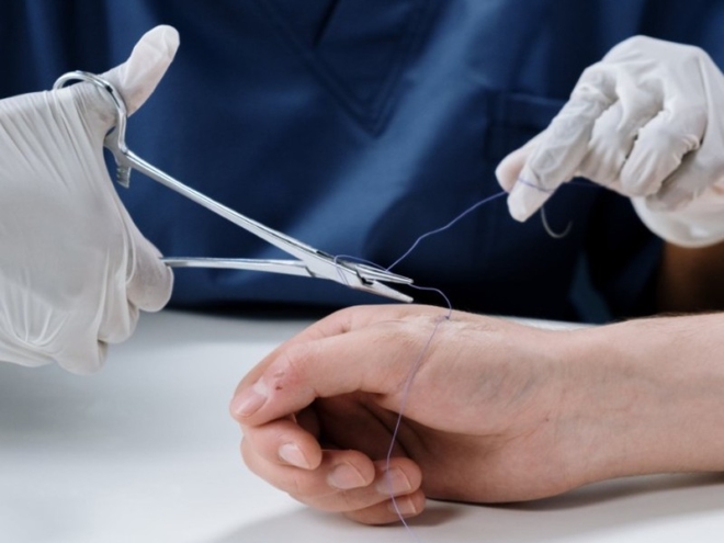 Řízení rizik zdravotnických prostředků dle ISO 14971